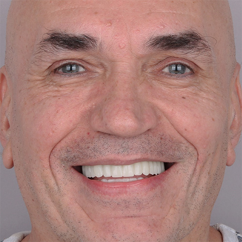Bogusław — po