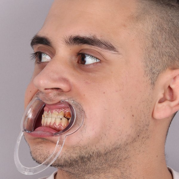 Przed profil prawy