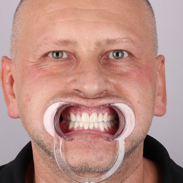Po przód