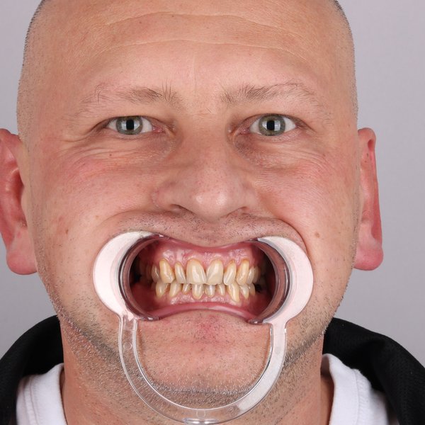 Przed przód