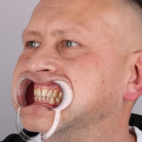 Przed profil prawy