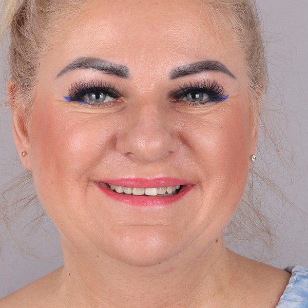 Małgorzata Przed Zabiegiem