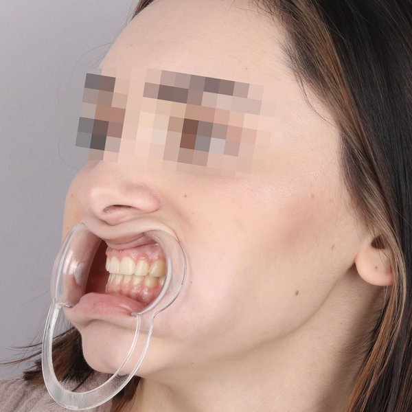 Przed profil prawy