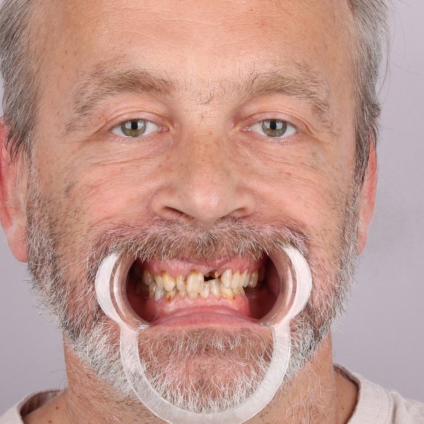 Przed przód