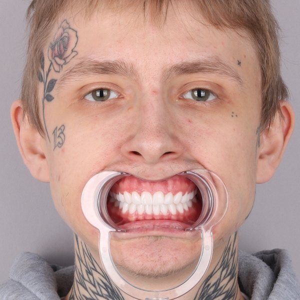 Po przód