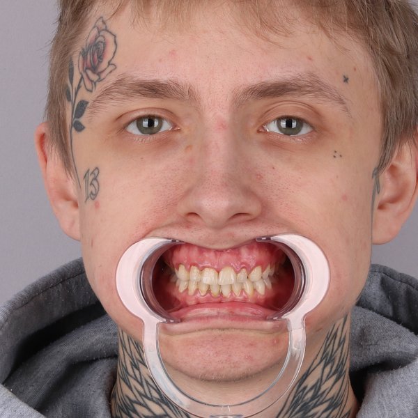 Przed przód