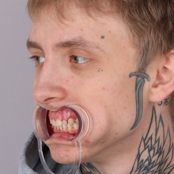 Przed profil prawy