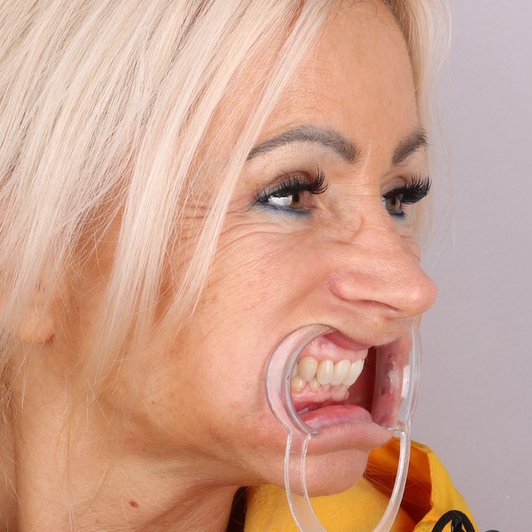 Przed profil lewy