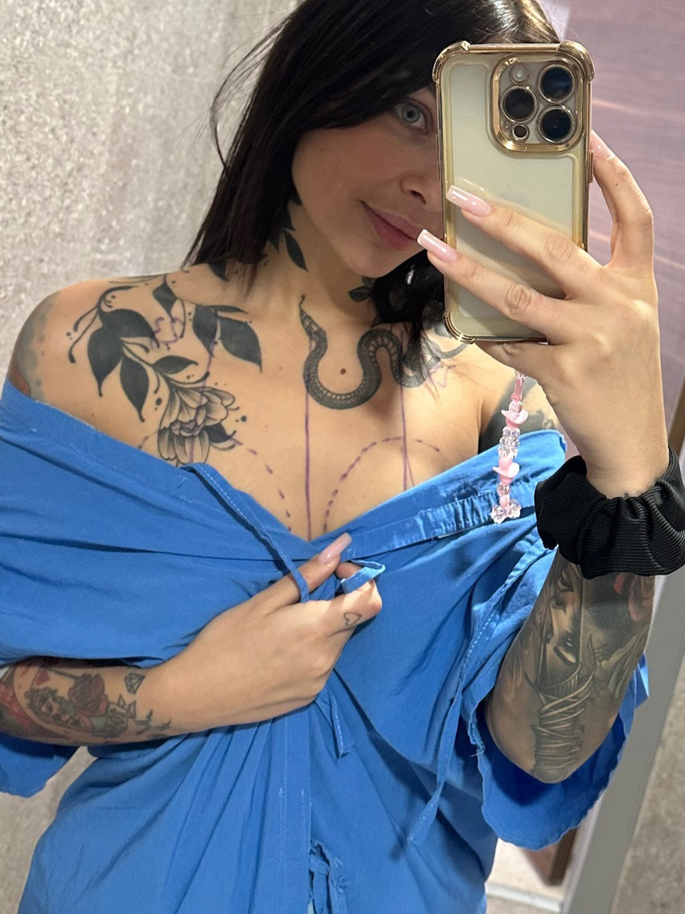 Paula — przed zabiegiem