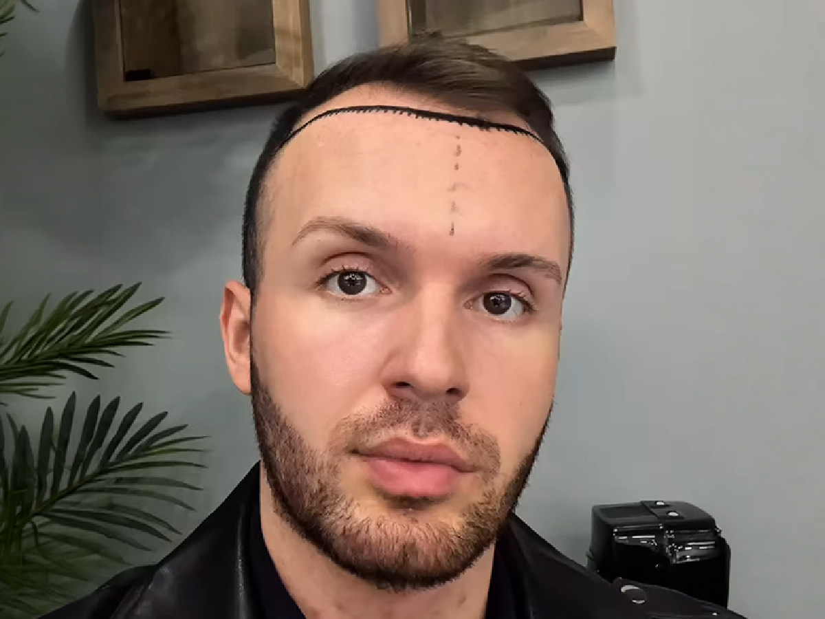 Wojciech Zawadzki — przed zabiegiem