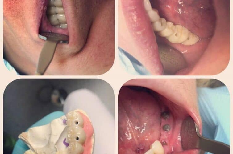 stomatologia przed i po