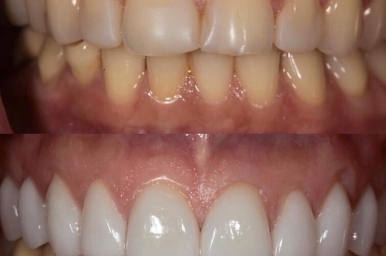stomatologia przed i po