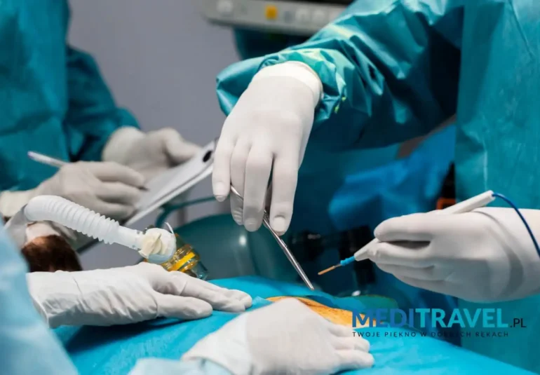 3-mity-na-temat-liposukcji-w-Turcji