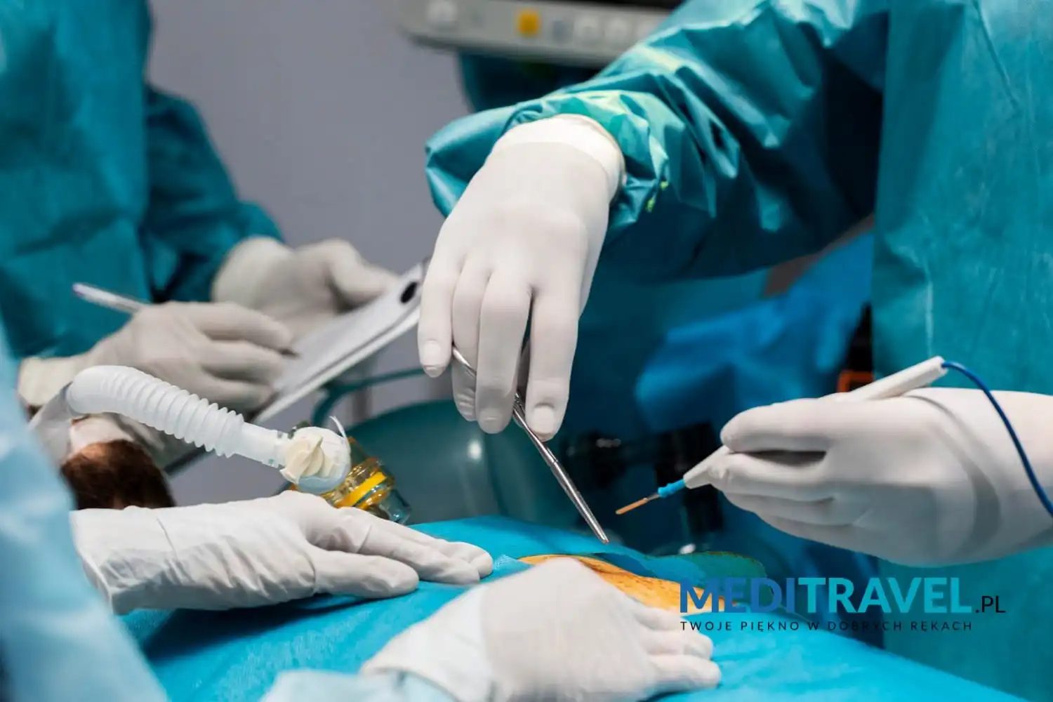 3-mity-na-temat-liposukcji-w-Turcji