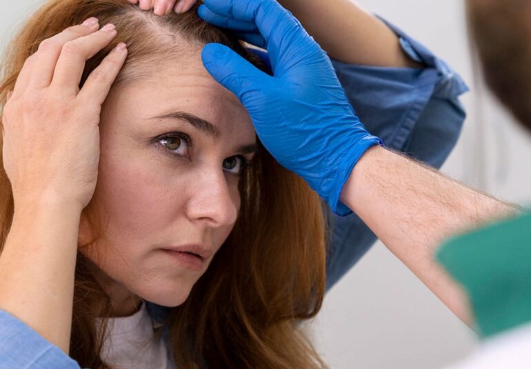 Przeszczep włosów u kobiet