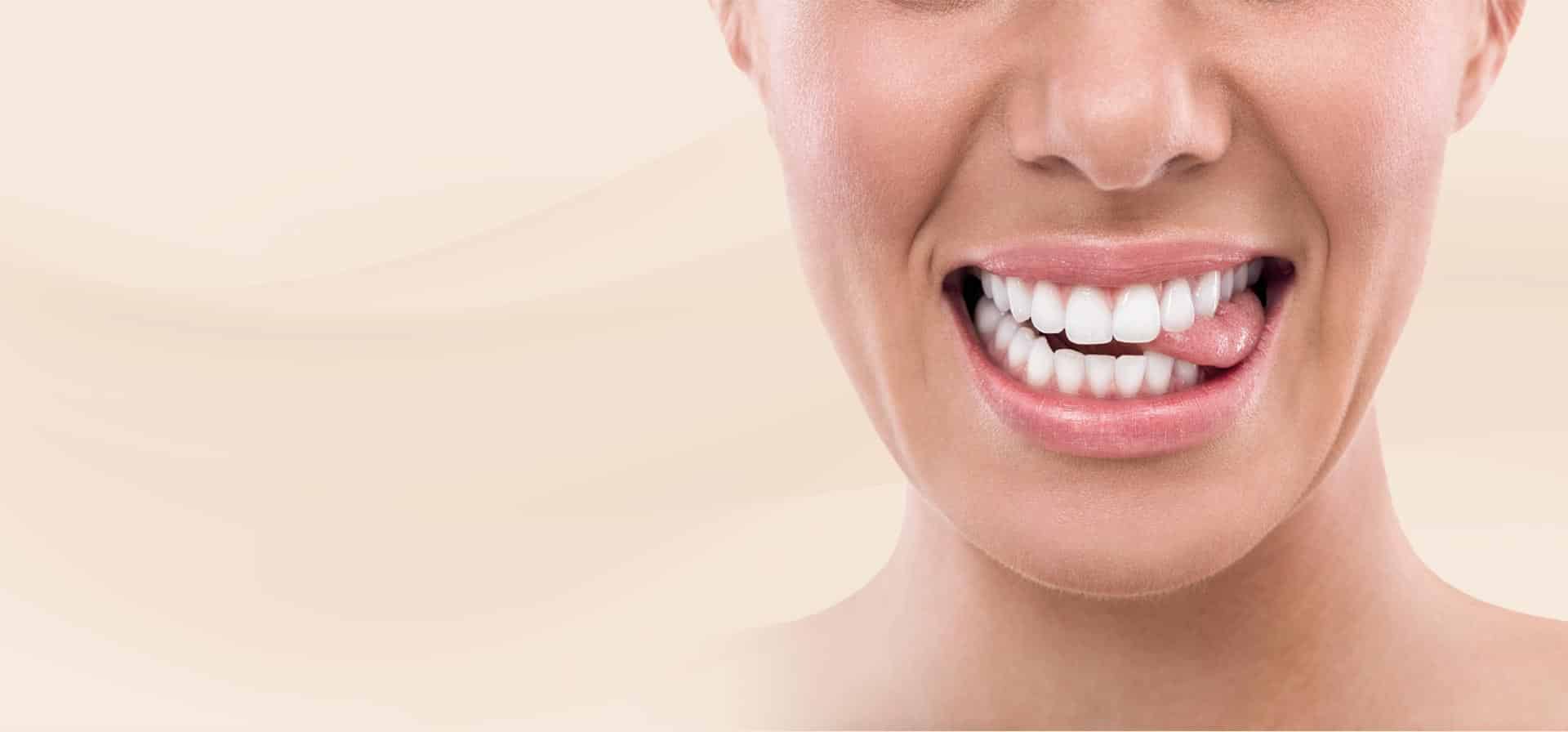 Hollywood Smile