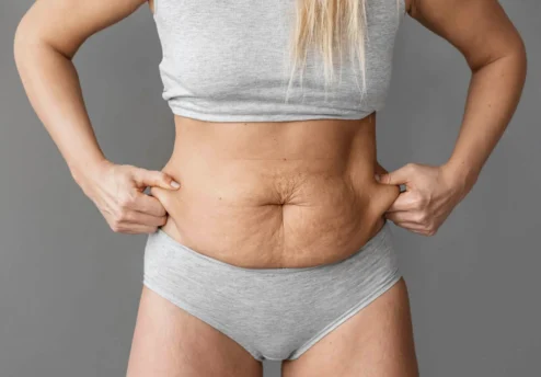 abdominoplastyka-piec-zasad-aby-uzyskac-najlepsze-wyniki