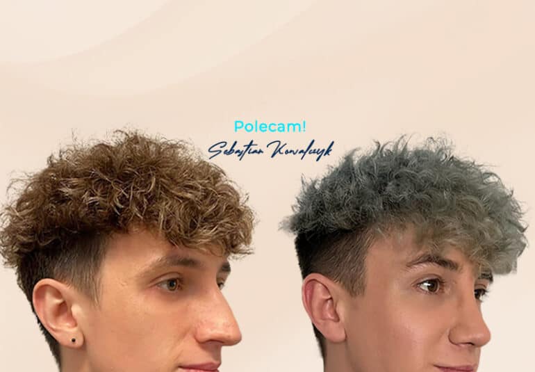 operacja-nosa