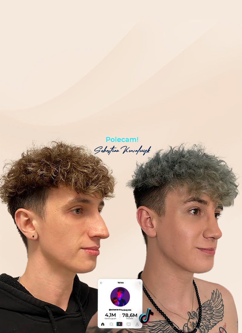 operacja-nosa