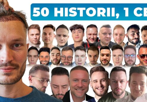 50 Polaków po przeszczepie włosów w Turcji – efekt metamorfozy po zabiegu przeszczepu włosów metodą FUE lub DHI