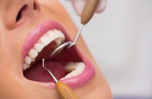 Dentysta bada zęby pacjentki przed zabiegiem Hollywood Smile w Turcji