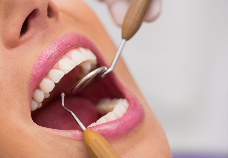 Dentysta bada zęby pacjentki przed zabiegiem Hollywood Smile w Turcji