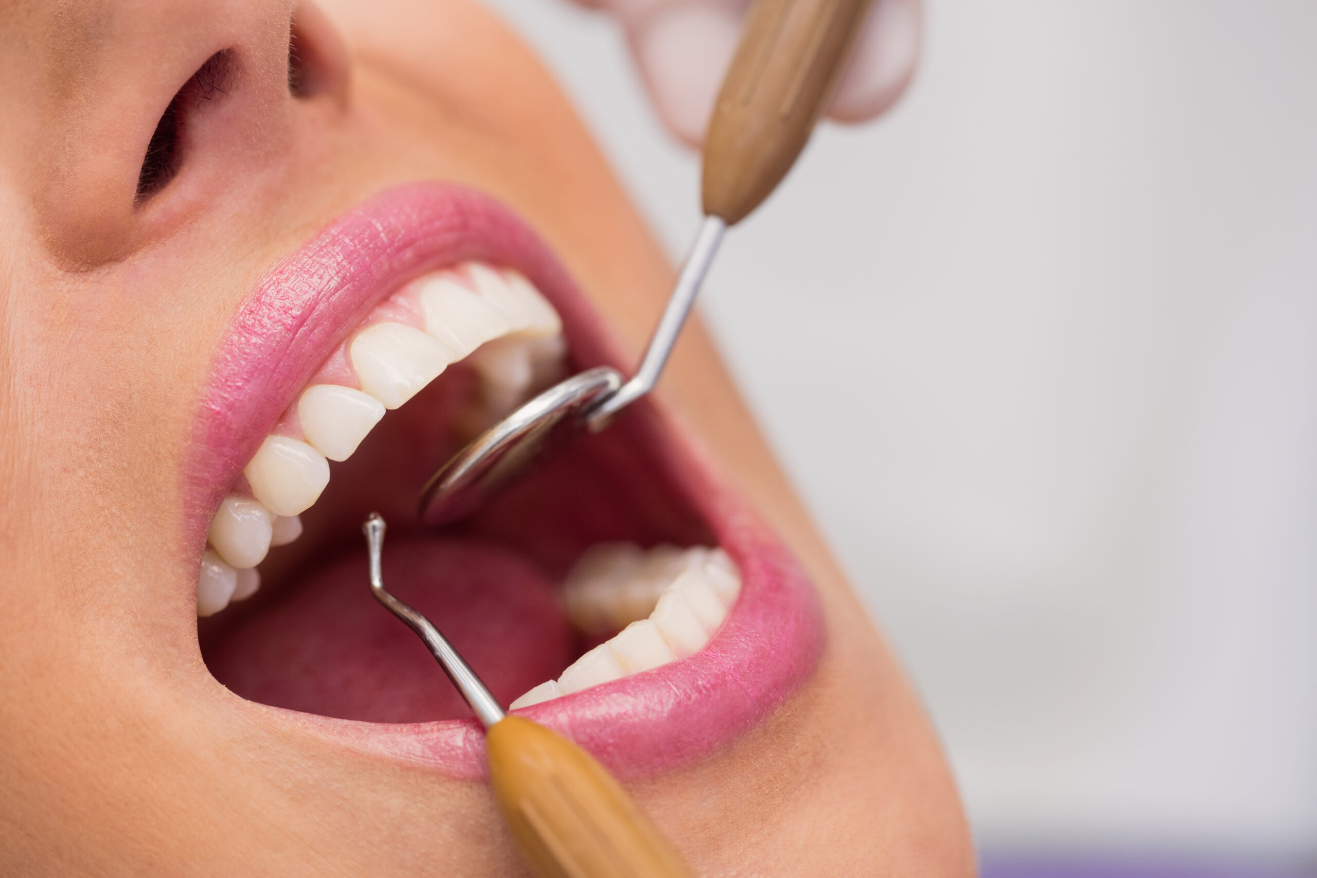 Dentysta bada zęby pacjentki przed zabiegiem Hollywood Smile w Turcji