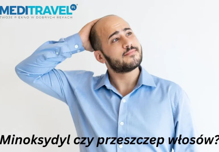 Minoksydyl czy przeszczep włosów