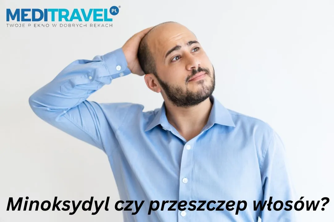 Minoksydyl czy przeszczep włosów