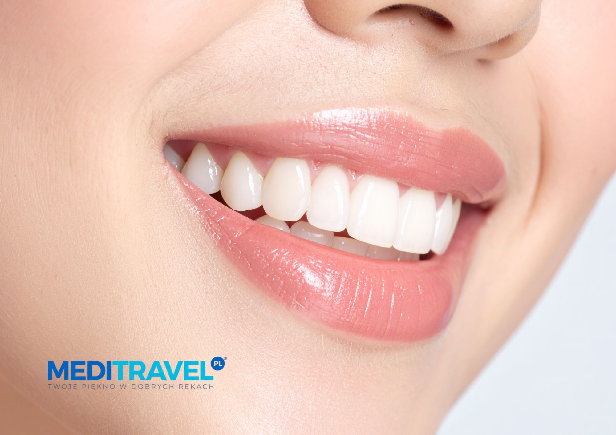hollywood smile