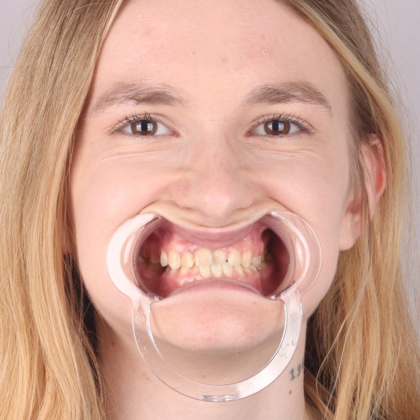 Przed przód