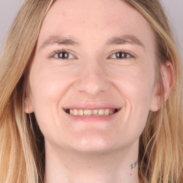 Joanna przed leczeniem