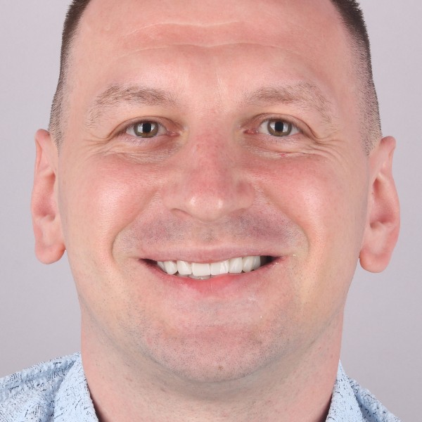 Metamorfoza uśmiechu, Hollywood Smile w Turcji