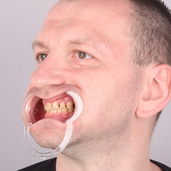 Przed profil prawy