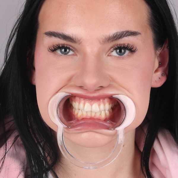 Przed przód