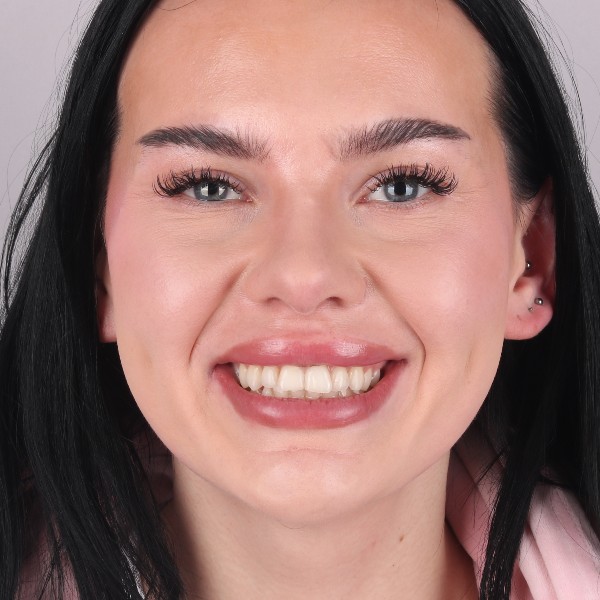 Sandra przed leczeniem