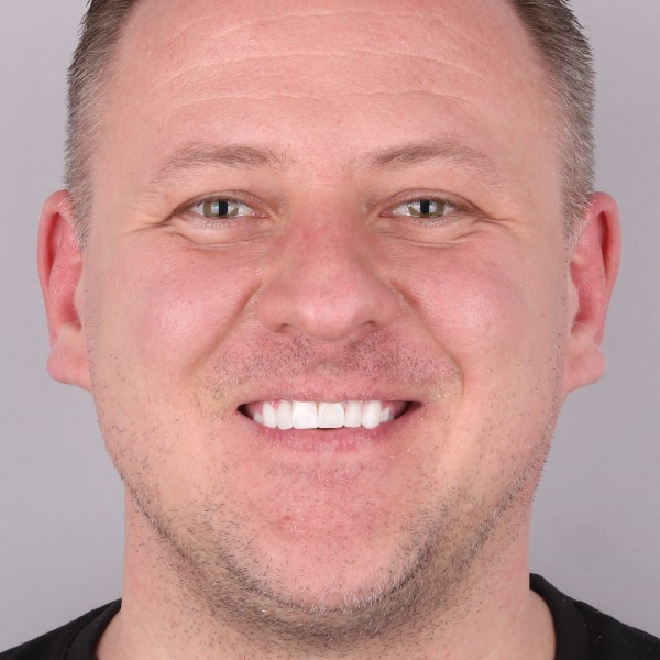 Grzegorz Po Zabiegu