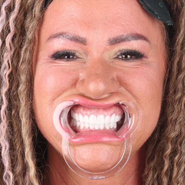 Po przód