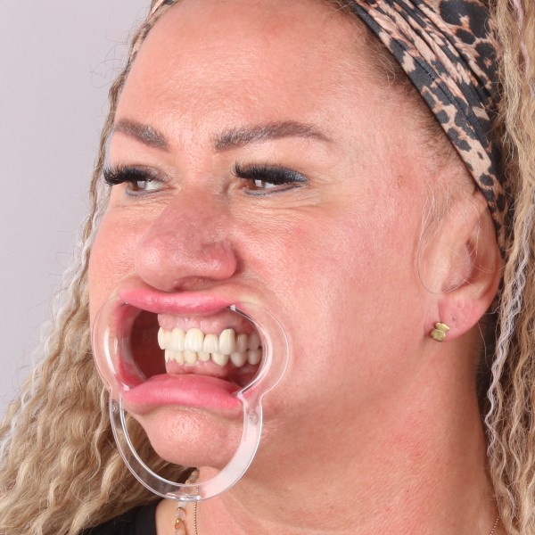 Przed profil prawy