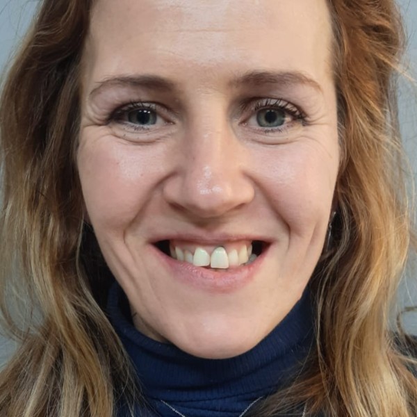 Agata Przed Zabiegiem