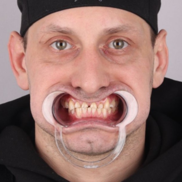 Przed przód