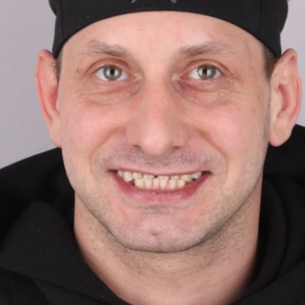 Damian przed leczeniem