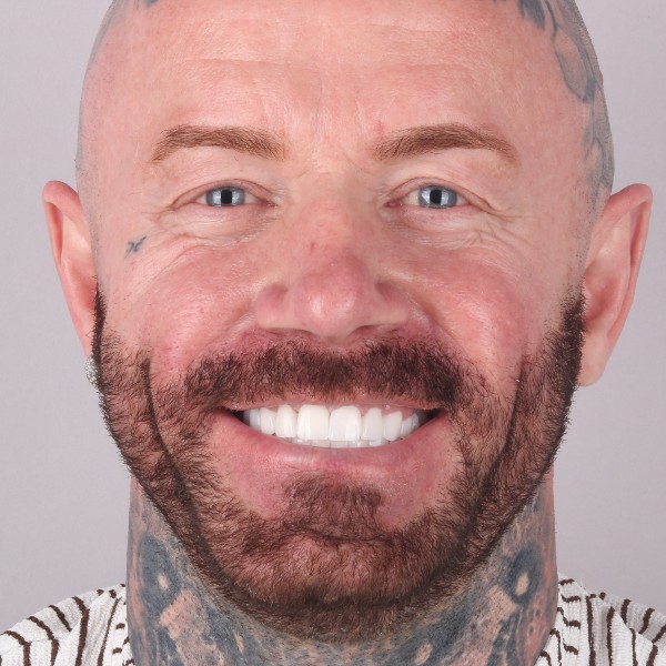 Damian Po Zabiegu