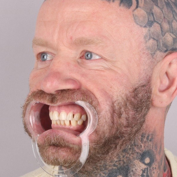Przed profil prawy