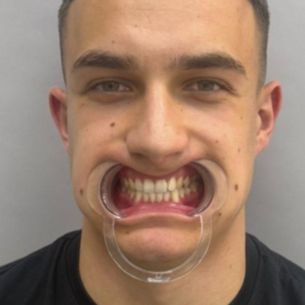 Przed przód