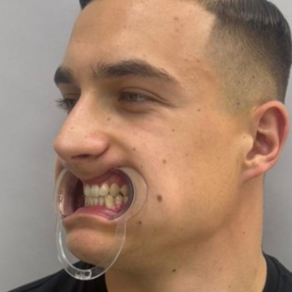 Przed profil prawy
