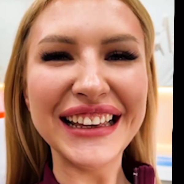 Jolanta Przed Zabiegiem