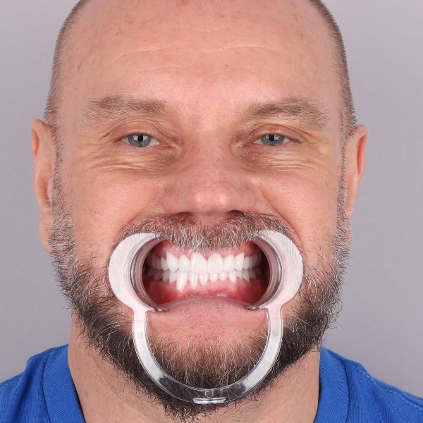 Po przód