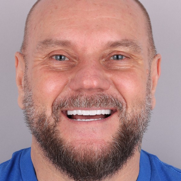 Arkadiusz po leczeniu w CE Hospital