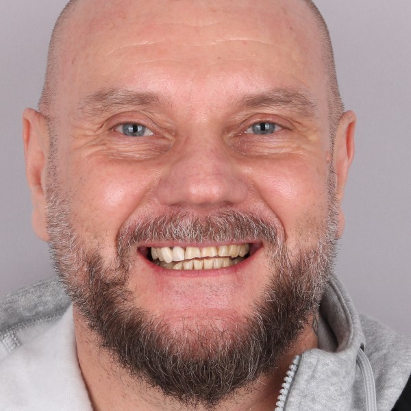 Arkadiusz przed leczeniem